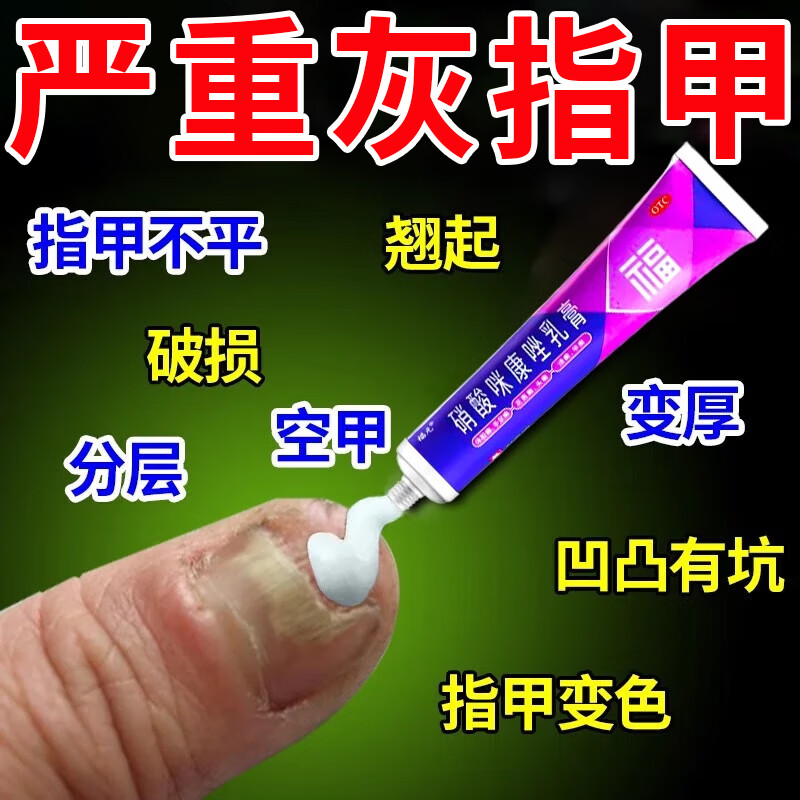 【福元】硝酸咪康唑乳膏2%*20g*1支/盒
