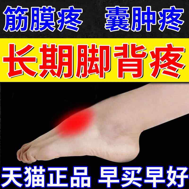 脚背筋膜炎疼痛脚面脚踝腱鞘炎囊肿贴鼓包肿痛扭伤喷雾膏药贴ck