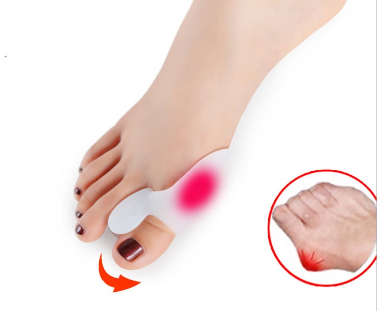 包邮硅胶大脚拇指外翻分