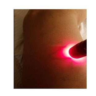 查找静脉显像仪血管显示仪手背穿刺检查血管 便携式红光血管灯