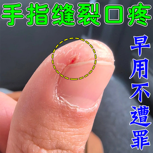 手裂口干裂修复膏冬季指甲缝干裂防手指裂口开裂痒粗糙脱皮护手霜