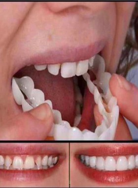 Perfect Oral Hygiene for Bad Teeth Smile Veneer No Toxic Pr
