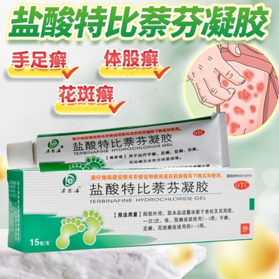 【得恩德】盐酸特比萘芬凝胶1%*15g*1支/盒股癣手癣足癣花斑癣体癣