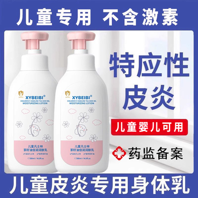 儿童特应性皮炎止痒根去【不再痒】光敏性过敏性特异性身体乳外用