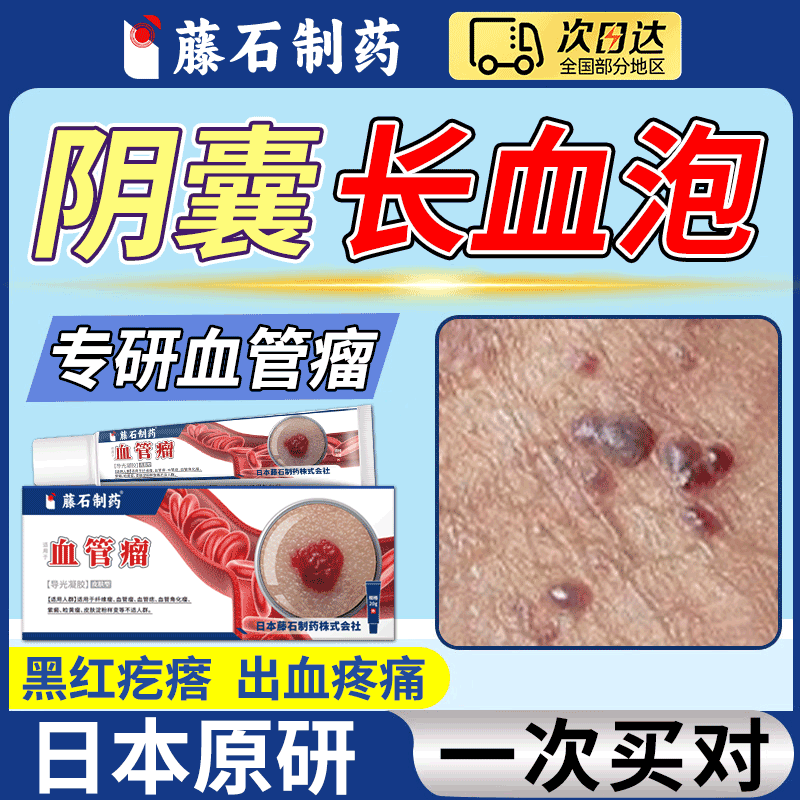 阴囊血泡毛细血管角化瘤睾丸血管痣黑红疙瘩红斑红点蜘蛛痣出血dw