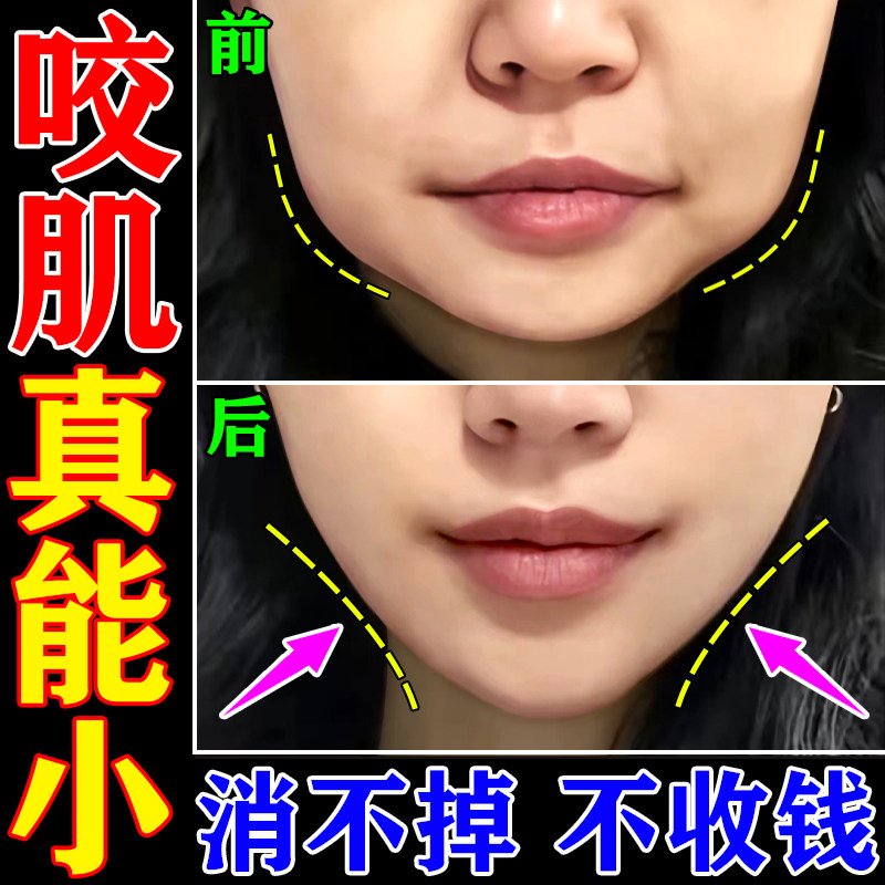 咬肌消除神器v脸瘦脸提拉紧致收双下巴去赘肉男士专用大小脸矫正