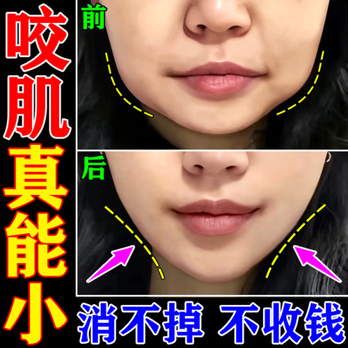 消除咬肌专用膏【保变小】