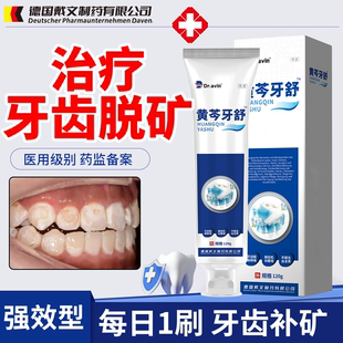 德国戴文治疗牙齿脱矿白斑钙化专用牙膏儿童成人均可用可搭配涂WT