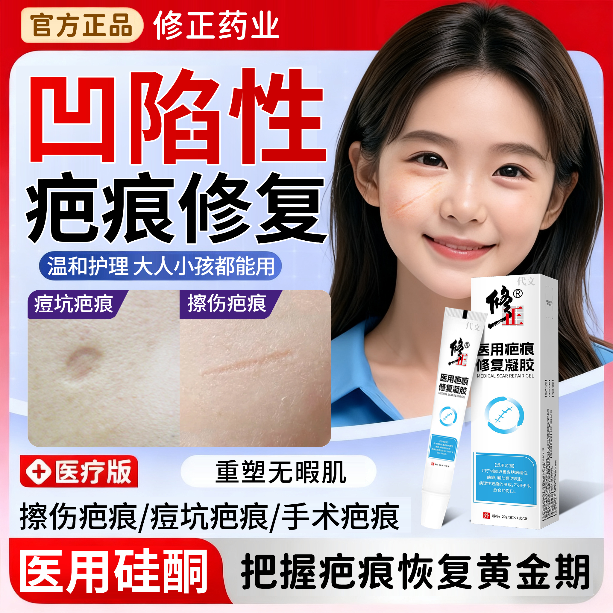 凹陷性疤痕修复除疤膏生长因子再生填充膏男女去祛痘坑凹凸凹洞WQ