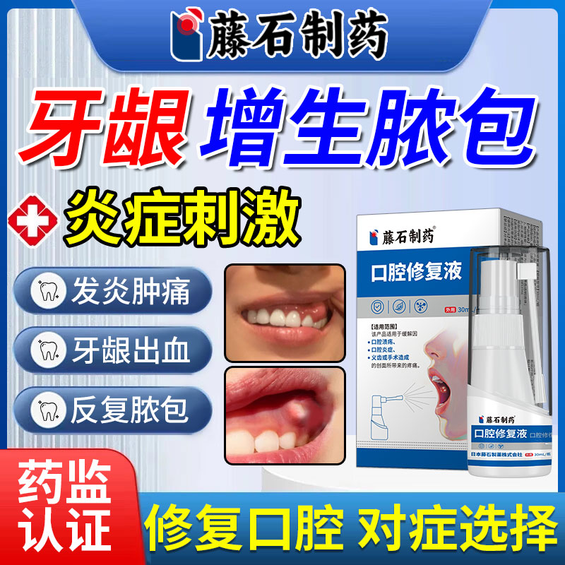 藤石口腔修复液牙龈脓包肿痛增生