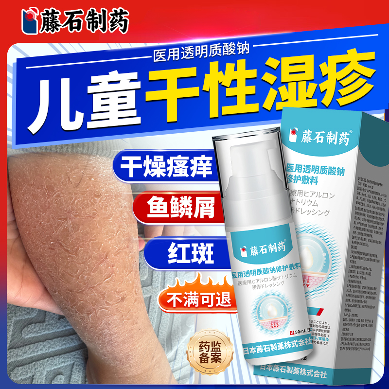 儿童干性湿疹干燥瘙痒脱屑
