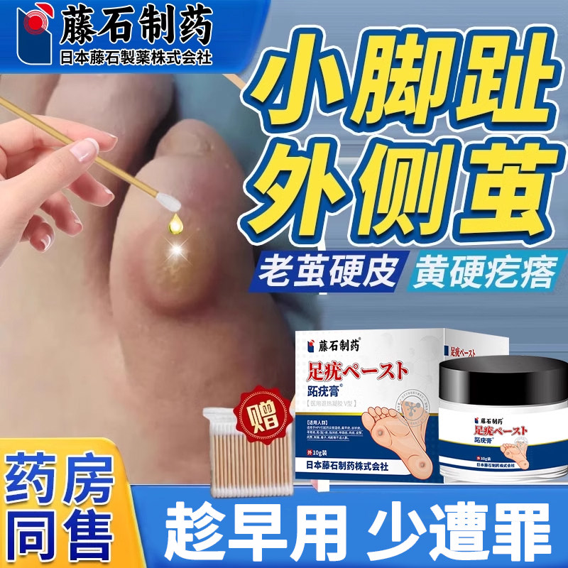 小脚趾疼痛磨出茧子去脚趾头老茧脚钉祛除膏鸡茧眼脚茧厚茧硬皮AA