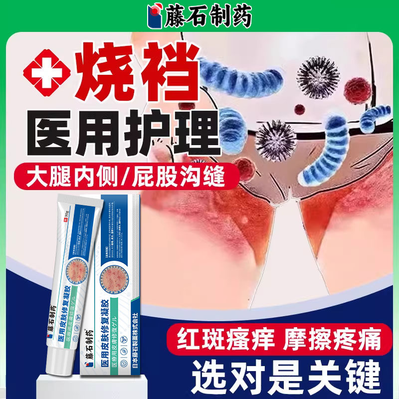 烧裆大腿内侧走路防摩擦屁股沟缝出汗瘙痒女男士淹裆药房同款膏TU