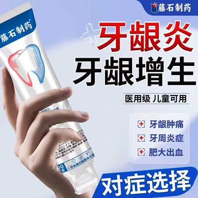 牙龈增生-出血肿痛肥大
