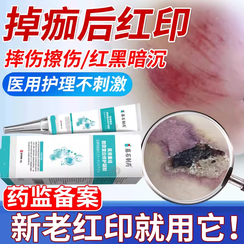 【医用护理】掉痂后红印疤印去除图片