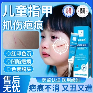 儿童指甲抓伤疤痕祛去疤修复膏专用小孩擦伤摔伤划伤除疤膏克XG