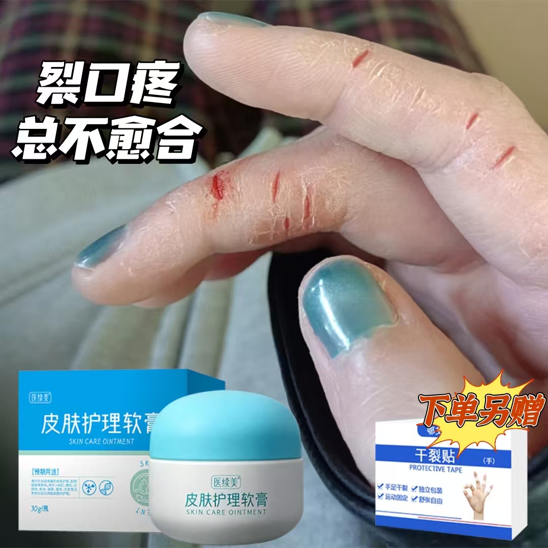 手指开裂口脱皮反复不愈专用