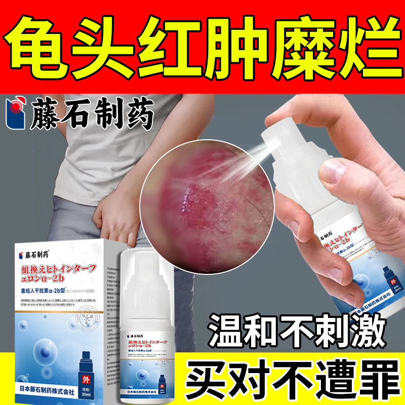 龟头炎上有小白点红斑红肿溃烂溃疡裂口真菌感染瘙痒疙瘩喷剂vq