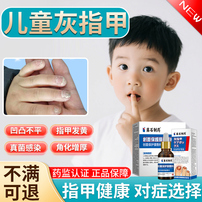 儿童灰指甲真菌感染抑菌液