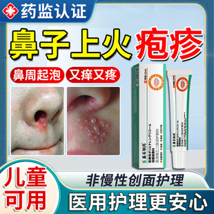 鼻子疱疹上火起泡烂嘴角鼻周口唇嘴巴病毒感染儿童断疱疹根软膏TU