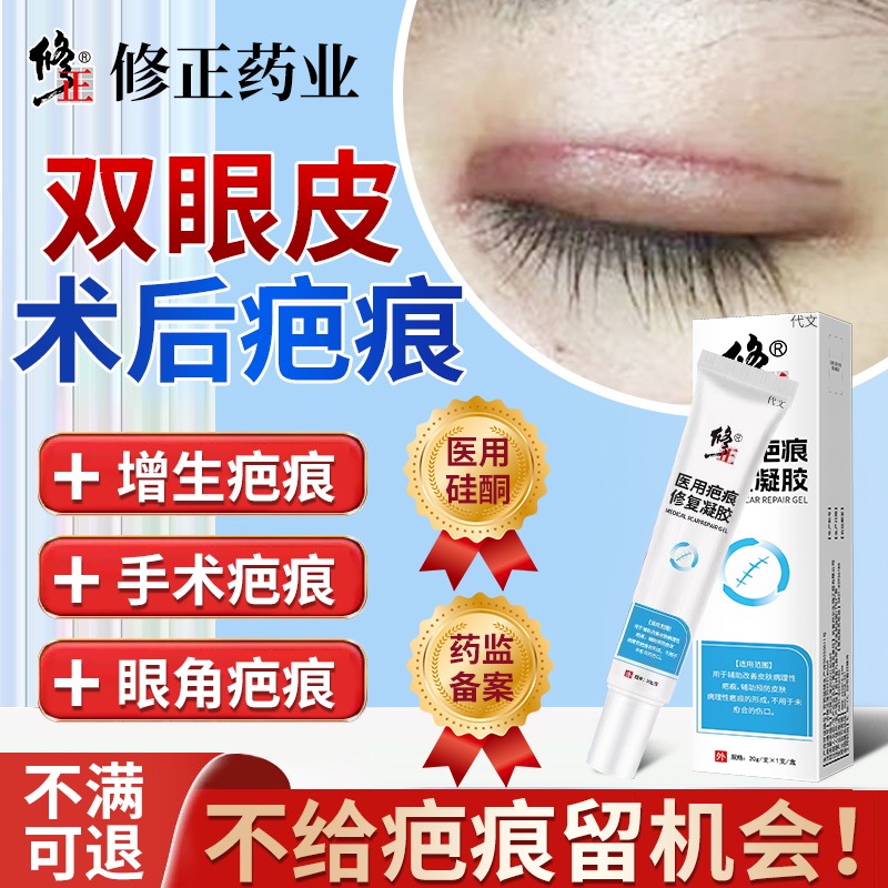 双眼皮术后祛疤膏--医用硅酮祛疤