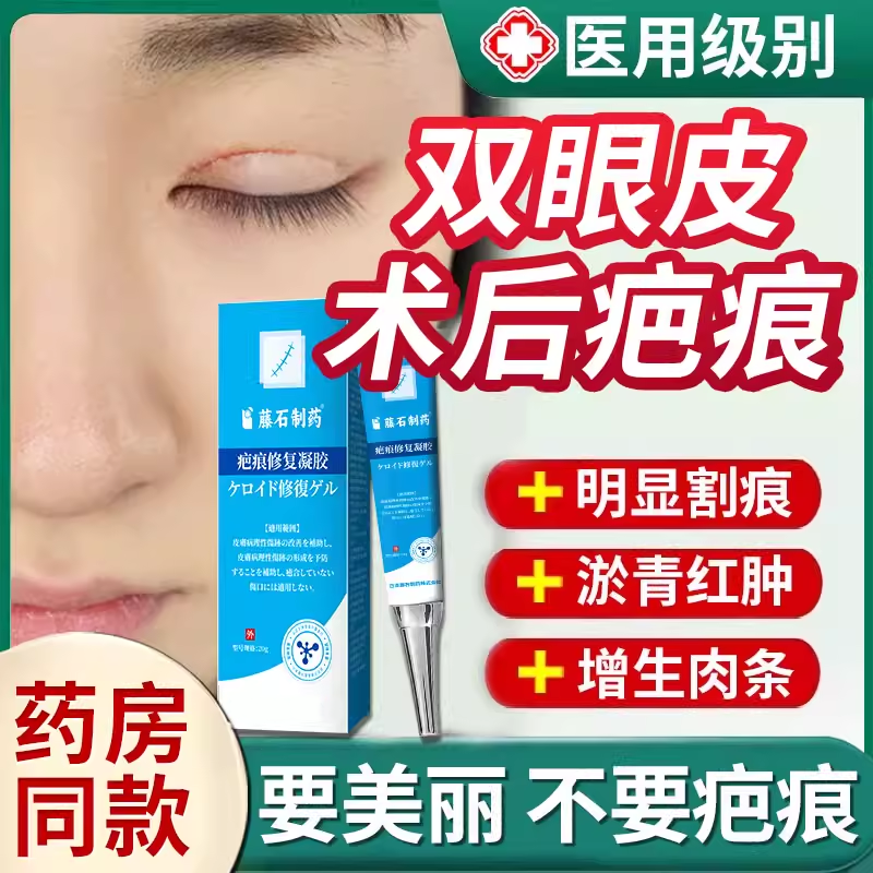 医用割双眼皮术后祛疤膏眼部手术增生开眼角消肿神器去疤痕膏TU