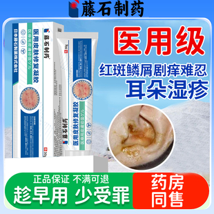 外耳道湿疹膏耳朵流水止痒去外用顽固皮炎根膏真菌感染药房同售DS