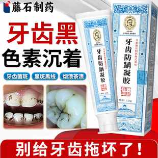 牙齿黑色素沉淀去除牙黑斑黑线儿童去牙菌斑黑牙牙膏祛除神器WQ