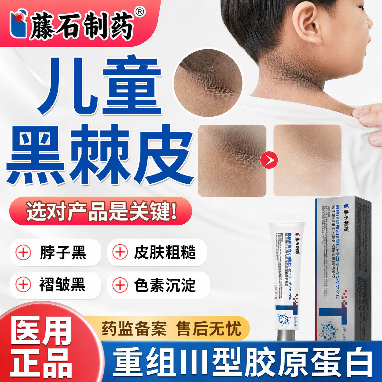 儿童去脖子黑棘皮肥胖黑色素沉淀治白愈康腋下药房同款膏医用型TU