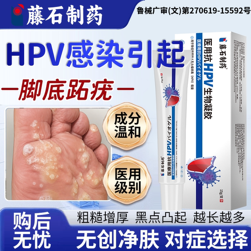 【速发】脚上跖疣医用抗HPV凝胶