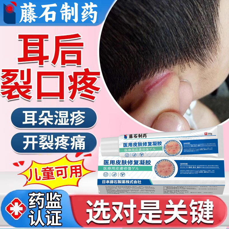 耳朵湿疹耳根开裂裂口耳垂外耳道耳背破溃渗液真菌感染药房同款HT,医疗器械,保健理疗,淘宝优惠券,粉丝福利购,淘宝优惠卷