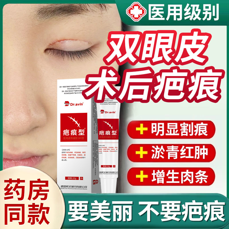 眼皮自然无痕双眼皮术后去疤膏