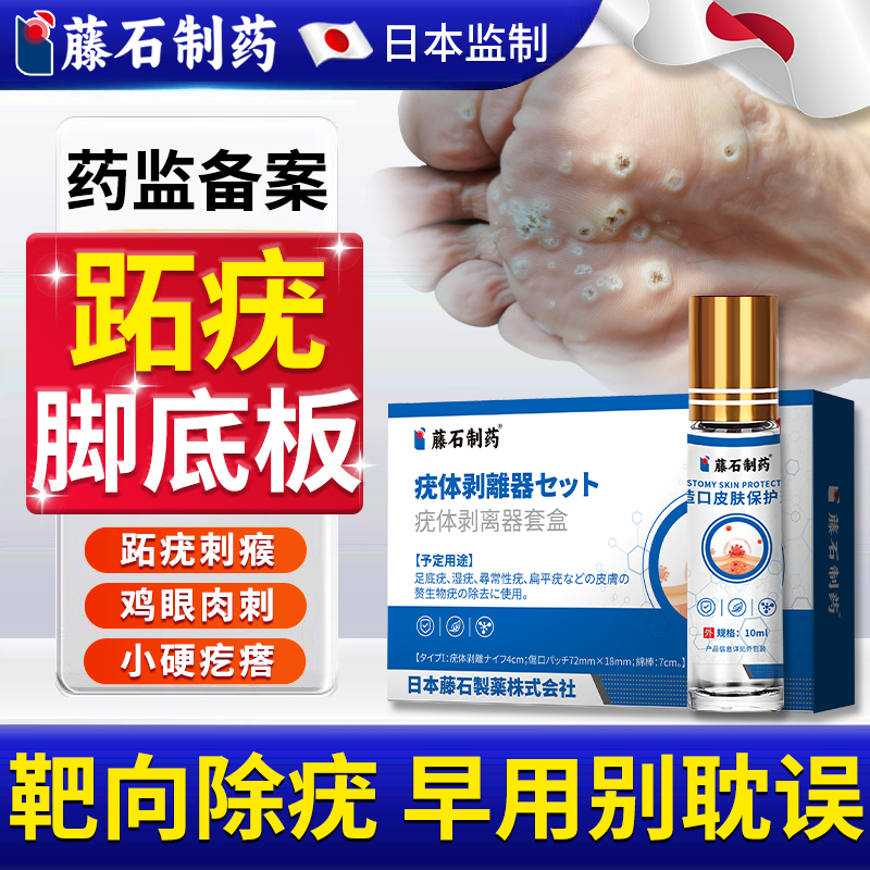 藤石制药脚底跖疣小疙瘩清除