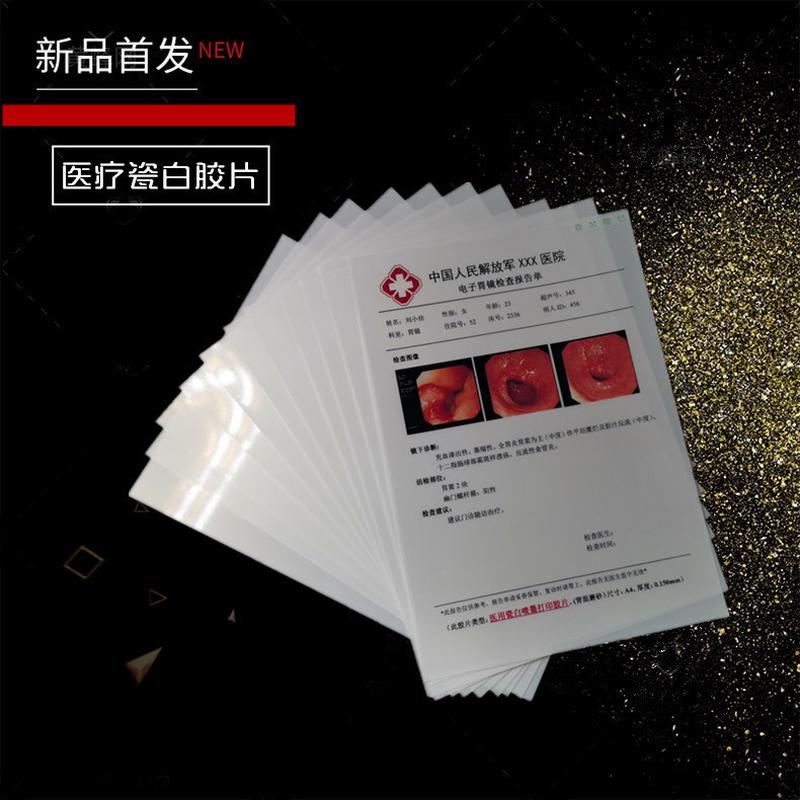 b超用胶片瓷白喷墨片胶片a4胶片胃镜医院四维彩超打印纸100张