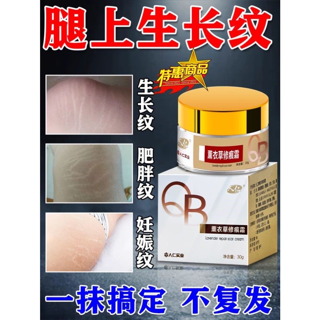 去肥胖纹生长纹修复霜消除大腿学生腰腹上肥胖纹去除男女通用药膏