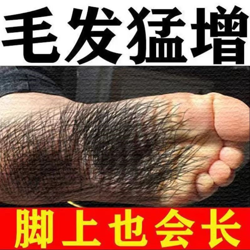 胡子生长液浓密毛发眉毛增长液胡须鬓角胸毛发际线神器膏生眉液男