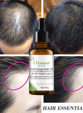 7 Days Hair Essential Oil Anti Hair Loss Hair Care Oil Prom