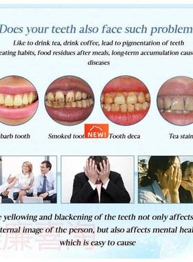 White Teeth Whitening Pen Tooth Gel Whitener Bleach Re