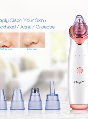 Pore-Cleaner Facial-Tools Face Cleansing Blackhead-Remover S