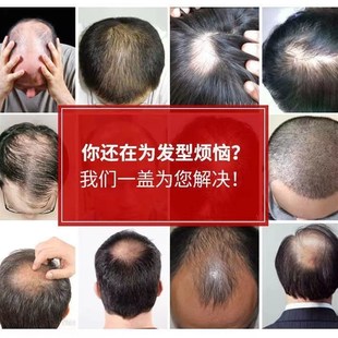 快速发货假发男短发头顶补发片男士时尚K三七分真发轻薄透气发际