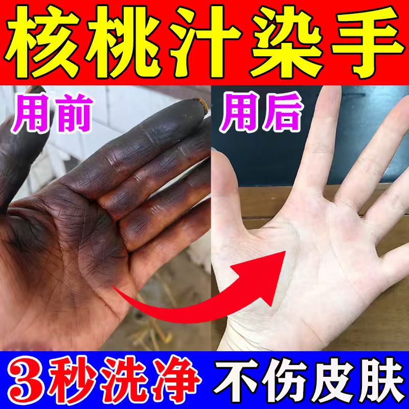 核桃汁清洗剂黑手快速褪色核桃汁残留不伤肤剥青皮用什么污渍去除