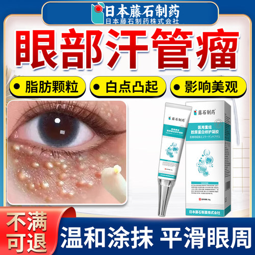 藤石制药汗管瘤眼部去专除神器祛脂肪粒扁平疣油脂粒用凝胶正品AZ