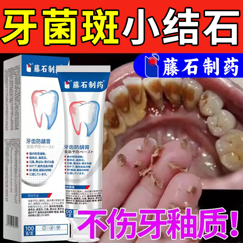 【医用级】牙结石专用
