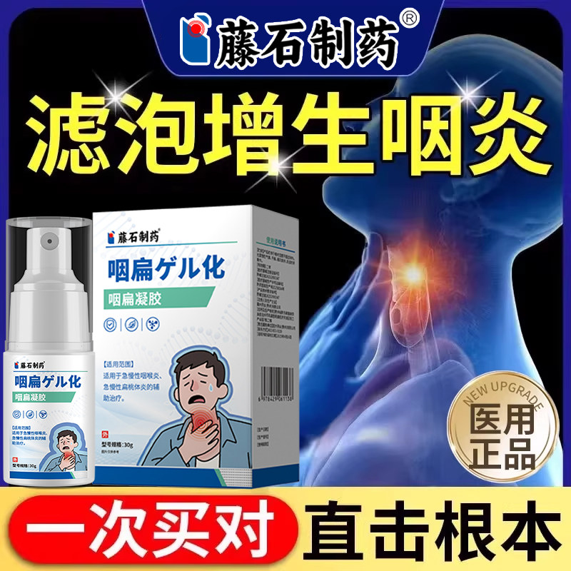 滤泡增生咽炎慢性咽炎咽后壁淋巴舌根喉咙发炎异物感喷剂BD