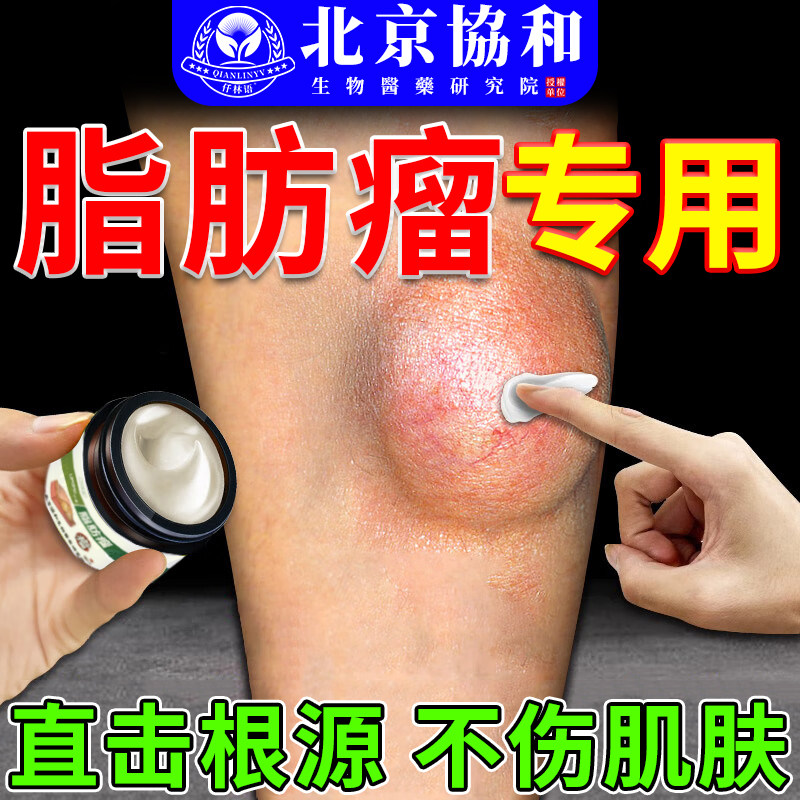 脂肪瘤消瘤膏去除神器肿硬块皮下消瘤膏药贴消除皮脂腺囊肿az