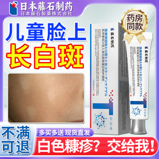藤石制药白色糠疹凝胶膏儿童脸上长白斑汗斑花斑癣面部干燥鳞屑GC