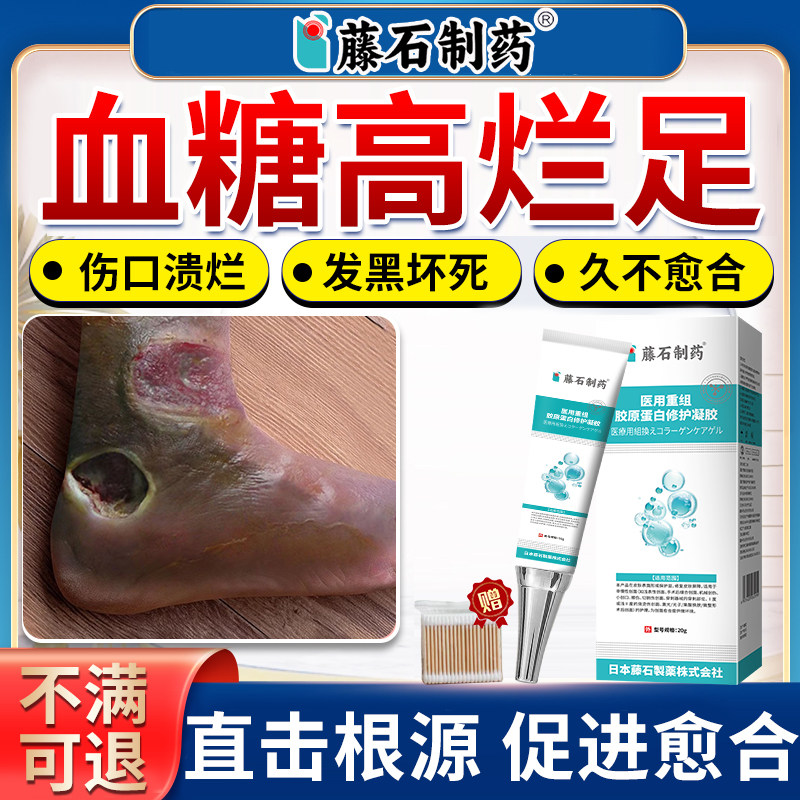 糖尿病引起烂足专用膏伤口愈合祛腐生肌促进伤口长肉可搭膏药贴AZ