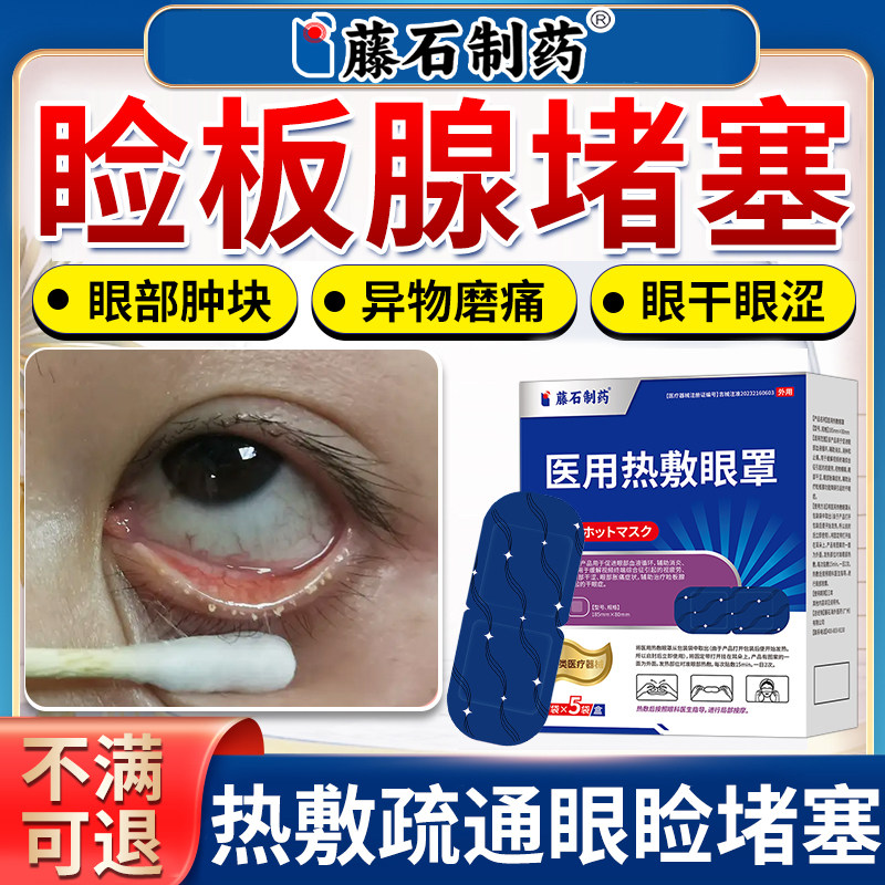 干眼症热敷治疗眼罩睑板腺堵塞疏通专用眼睛异物感眼干眼涩眼贴AZ
