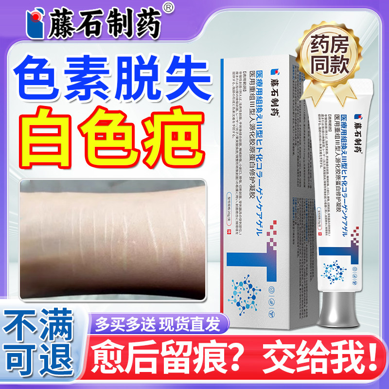 色素脱失白色疤痕修护术后疤痕皮肤祛皮肤白斑黑色素疤痕增生RB