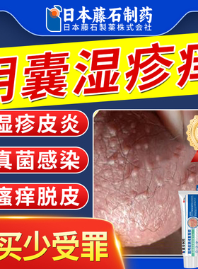 阴囊湿疹瘙痒止痒专用男性私处睾丸痒屁股湿疹慢性股藓真菌感染AZ